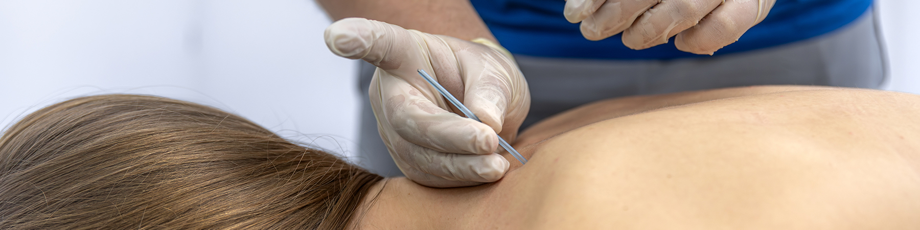 Terapia dermatofuncional en la clínica Loli Poveda Albacete